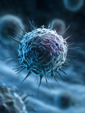 Clinical Outcomes of Acute Pancreatitis in Patients With Multiple Myeloma