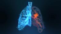 Efficacy and Safety of Immune Checkpoint Inhibitors Combined With Chemoradiotherapy in Limited-Stage Small Cell Lung Cancer: © appledesign - stock.adobe.com