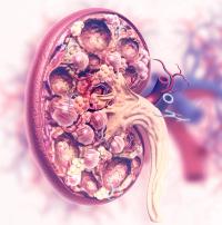 A phase 1/2 trial will evaluate N17350 in patients with pretreated, advanced solid tumors, such as head and neck neoplasms, NSCLC, and melanoma, among others.