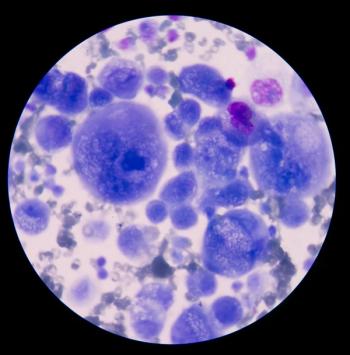 Patients with relapsed/refractory multiple myeloma appear to benefit from treatment with teclistamab, which was given a positive opinion by the European Medicines Agency’s Committee for Medicinal Products for Human Use.