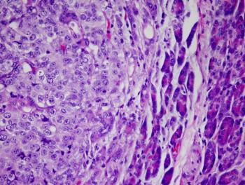 Subgroup findings suggest a PFS benefit with the addition of encorafenib/binimetinib in patients with liver metastases.
