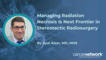 Ayal Aizer, MD, MHS, discusses radiation necrosis as the next major challenge in stereotactic radiosurgery for brain metastases and how clinicians can address it.