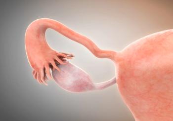 Mirvetuximab soravtansine additionally showcased PFS, ORR, and DOR benefits over chemotherapy in FRα-positive platinum-resistant ovarian cancer.