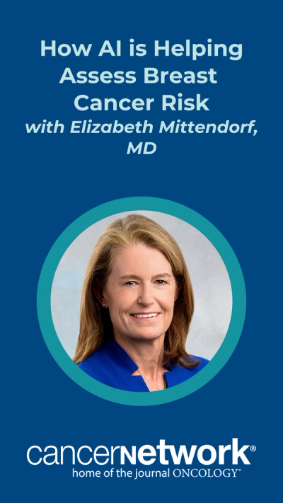 How AI is Helping Assess Breast Cancer Risk