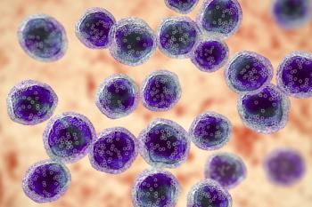 The combination of melflufen plus dexamethasone produced a progression-free survival benefit over pomalidomide plus dexamethasone in patients with transplant-naïve relapsed/refractory multiple myeloma.