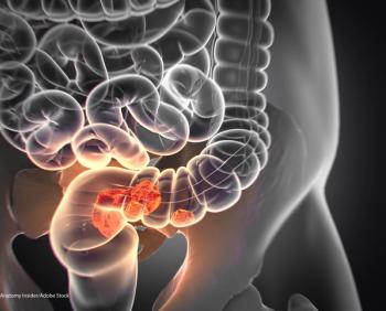 KRAS/BRAF Testing May Help Define Stage III Colon Cancer Prognosis | Image Credit: © Anatomy Insider - stock.adobe.com.