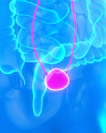 Updated results from SunRISe-4 support further investigation of the gemcitabine intravesical system plus cetrelimab in MIBC.