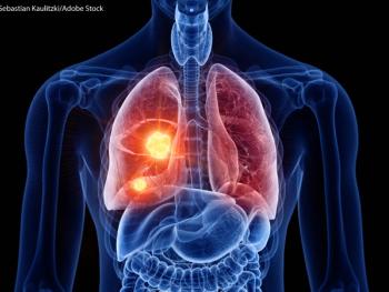 The decision is based on results from the phase 1/2 SOHO-01 trial evaluating the agent in patients with advanced HER2-mutant non–small cell lung cancer.