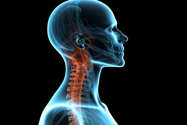 X ray of human head neck pain anatomy generative ai | Image Credit: © shahzaib - stock.adobe.com