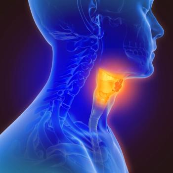 3d illustration of throat cancer | Image Credit: © Lars Neumann - stock.adobe.com