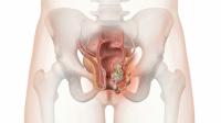 Pelareorep Receives FDA Fast Track Designation in SCAC: © Maryia - stock.adobe.com