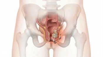Pelareorep Receives FDA Fast Track Designation in SCAC: © Maryia - stock.adobe.com
