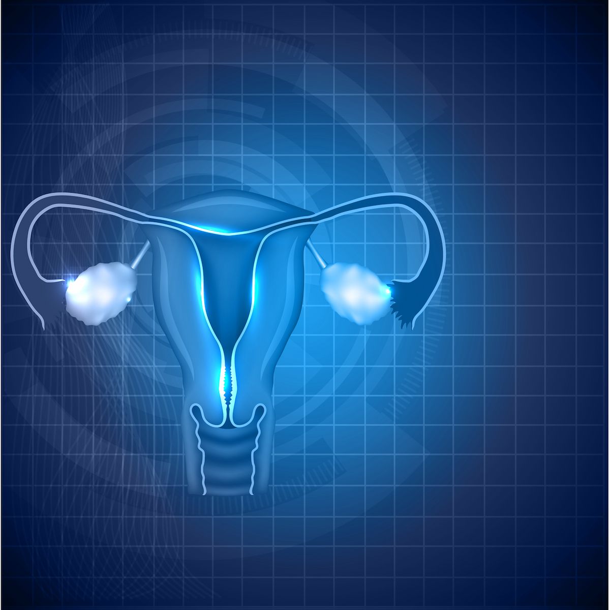 Researchers prospectively analyzed the effect of implementing systemic outpatient identification on initiating goals of care conversations for high-risk patients with gynecologic cancers.