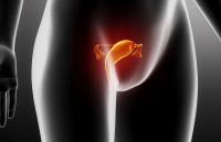 Among 35 patients with ovarian cancer treated with an antibody-based combination, the overall response rate was 23%, with a clinical benefit rate of 31%.