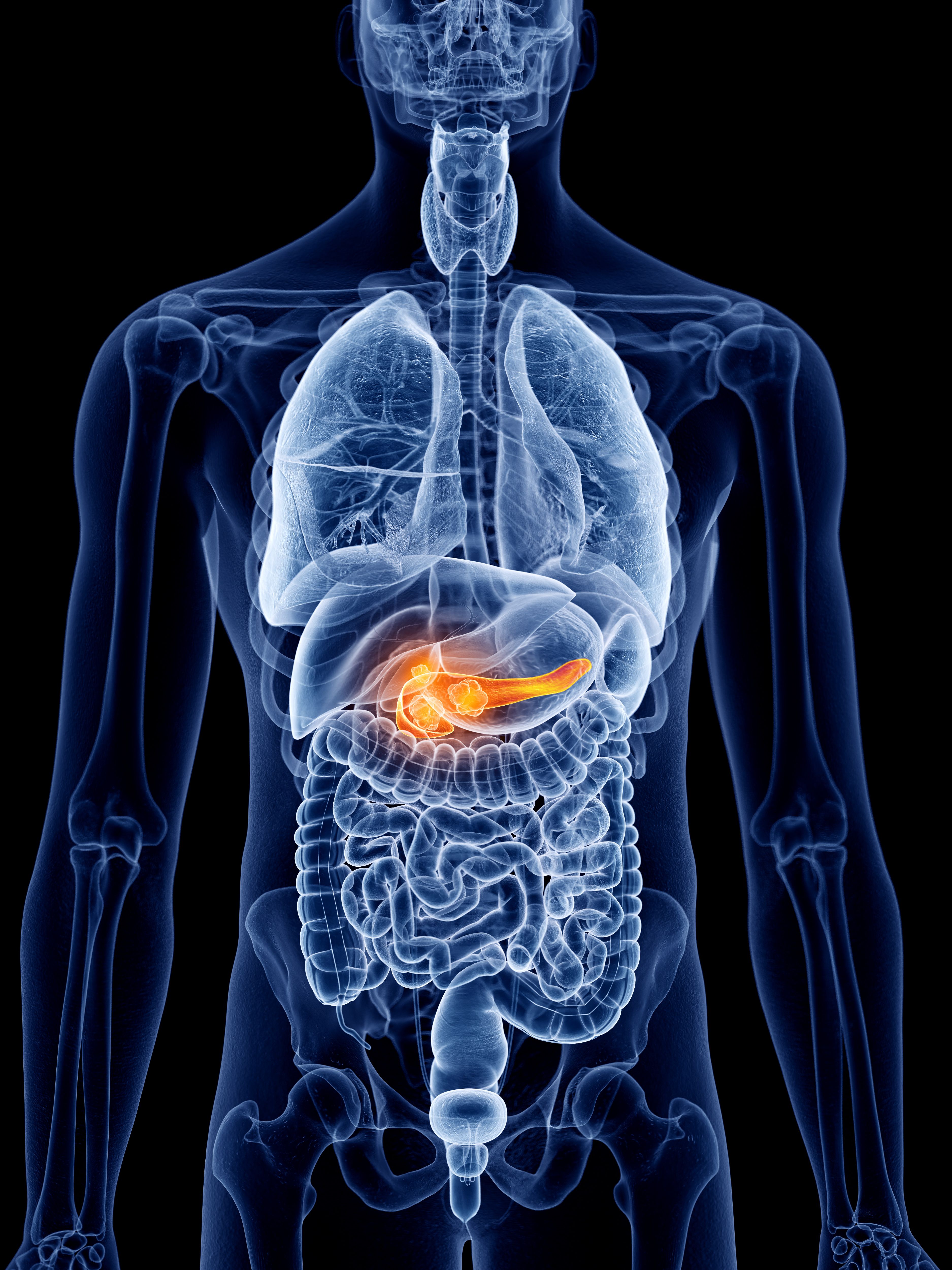Pancreatic Cancer