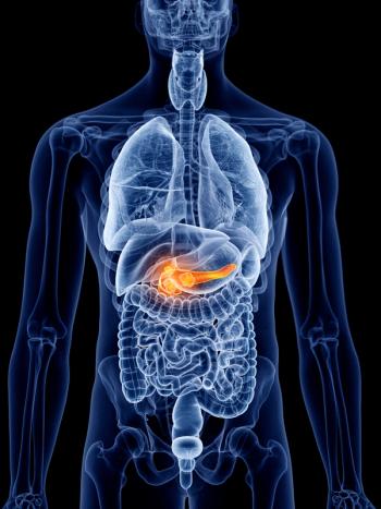 Pancreatic Cancer