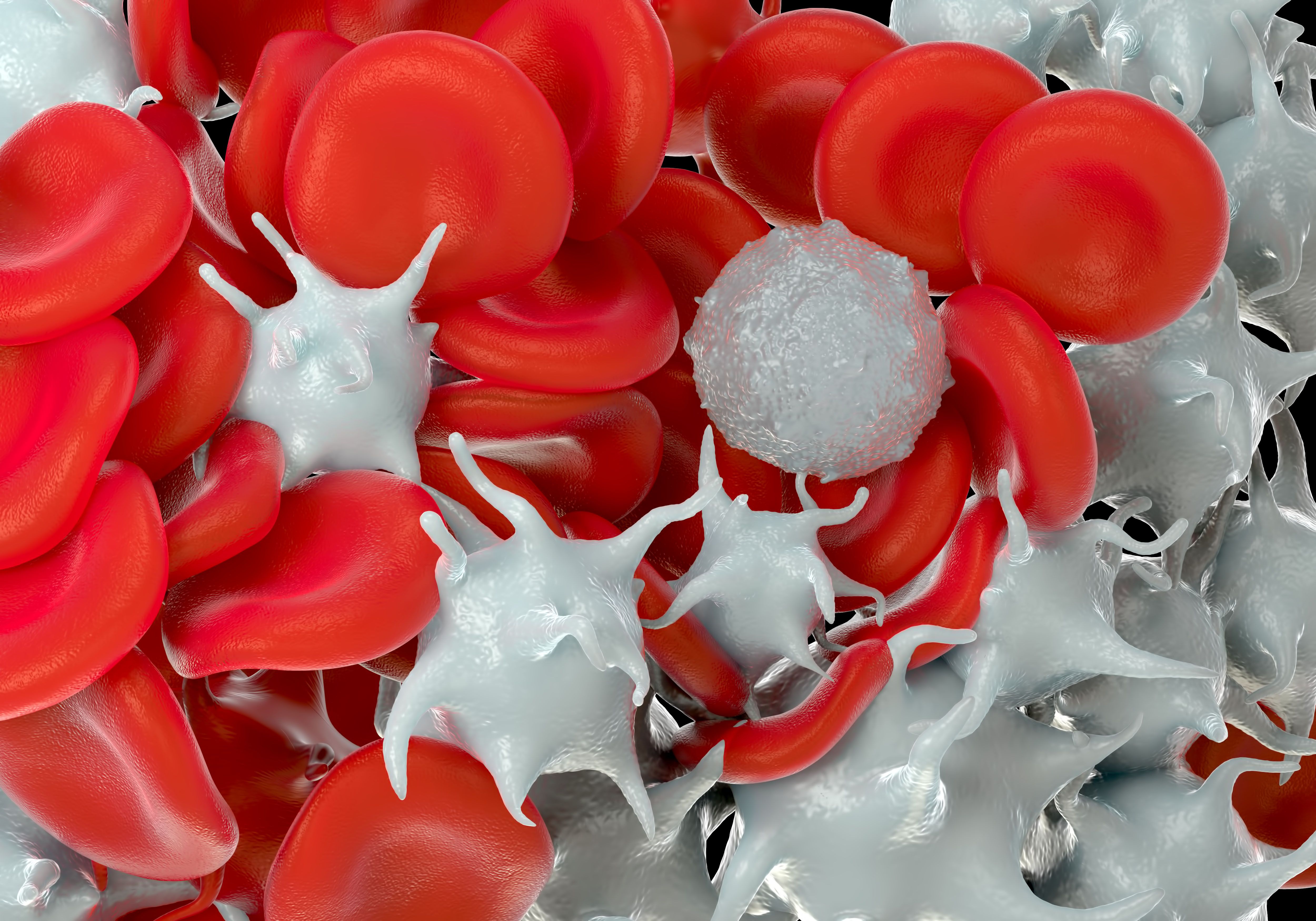 acute lymphoblastic leukemia
