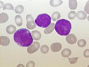 Administering pegylated asparaginase continuously to pediatric patients with acute lymphoblastic leukemia appears to be safe without compromising the efficacy of treatment.