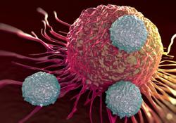 Multiprong Leukemia Efforts Boost the Atlantic Health System Heme/Onc Program 