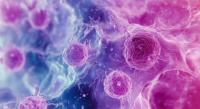 B-Cell Lymphoma Awareness: Photomicrograph of Diffuse Large B-Cell Lymphoma (DLBCL) - Histology and Biopsy Study | Image Credit: © Maryna - stock.adobe.com