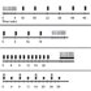 Treatment Recommendations for Anaplastic Oligodendrogliomas That Are Codeleted