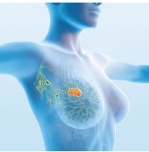 Key Advances in Oncology, 2018