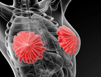 Research presented at the 2021 San Antonio Breast Cancer Symposium highlighted survival improvements for postmenopausal women with hormone receptor (HR)–positive HER2-negative advanced breast cancer when treated with ribociclib plus letrozole over placebo.