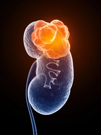 Collaborators in the Kidney Cancer Research Consortium aim to address mechanistic and scientifically driven questions in the kidney cancer field.