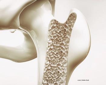 The denosumab-bmwo products Stoboclo and Osenvelt have been approved as interchangeable with the denosumab products Prolia and Xgeva, respectively. 