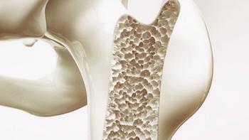 The denosumab-bmwo products Stoboclo and Osenvelt have been approved as interchangeable with the denosumab products Prolia and Xgeva, respectively.