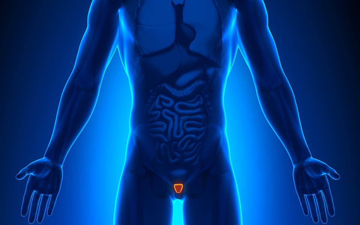 Germline Testing in Prostate Cancer: When and Who to Test