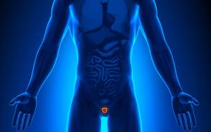 Germline Testing in Prostate Cancer: When and Who to Test