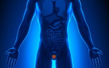 Abiraterone Acetate and Prednisolone–Based Treatment Improves Metastasis-Free, Overall Survival in High-Risk Nonmetastatic Prostate Cancer