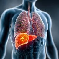 The CARES-310 Regimen Receives Third Complete Response Letter in HCC: © zhi - stock.adobe.com