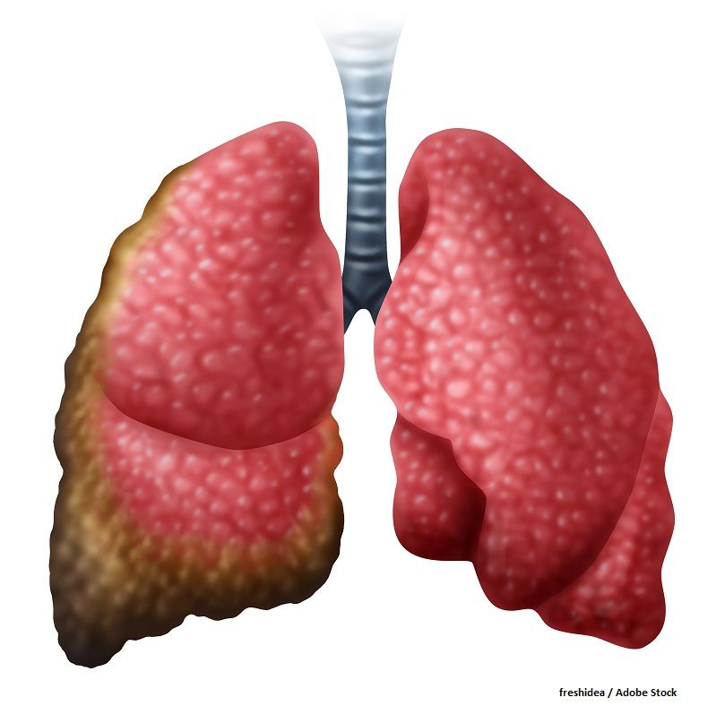In July 2025, the FDA granted accelerated approval to sunvozertinib as a treatment for adults with locally advanced or metastatic non–small cell lung cancer harboring EGFR exon 20 insertion mutations as detected with an FDA-approved test following progression on or after platinum-containing chemotherapy.