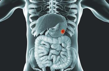 A survival analysis revealed an OS benefit was observed with durvalumab across demographic subgroups and clinical characteristics.
