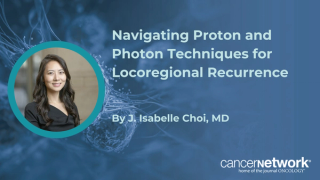 Navigating Proton and Photon Techniques for Locoregional Recurrence