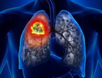 Pembrolizumab Plus Ramucirumab Yields Improved Survival Vs SOC in ICI-Resistant NSCLC