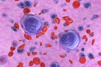 Acute myeloid leukemia (AML) cells in blood flow - isometric view 3d illustration | Image Credit: © LASZLO - stock.adobe.com.