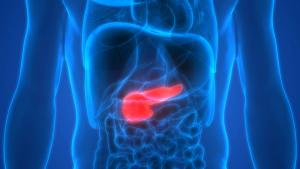 Barriers to Pancreatic Cancer Clinical Trials Enrollment