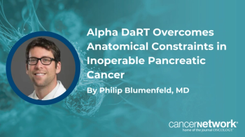Philip Blumenfeld, MD, discussed the biological rationale and distinct mechanism of action of EUS-guided radium-224 Alpha DaRT in pancreatic adenocarcinoma.
