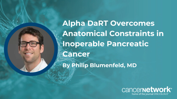 Philip Blumenfeld, MD, discussed the biological rationale and distinct mechanism of action of EUS-guided radium-224 Alpha DaRT in pancreatic adenocarcinoma.