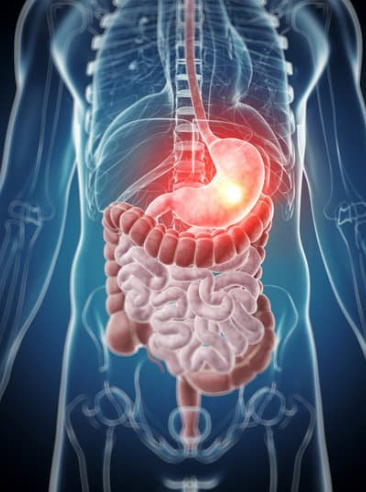 A retrospective review found that external-beam radiation therapy has been underutilized as a bridging therapy in patients with hepatocellular carcinoma seeking transplant, although its prevalence has increased over the past decade.