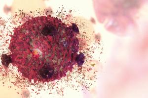 Management of Steroid-Refractory Immune-Related Adverse Events