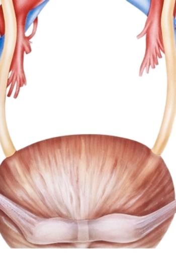 Patients with non-muscle invasive bladder cancer unresponsive to Bacillus Calmette-Guerin may benefit from treatment with CG0070 plus pembrolizumab.