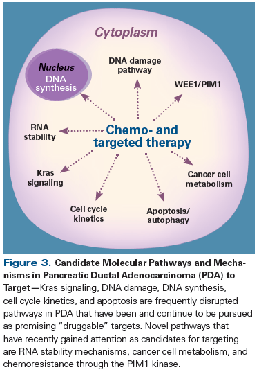 pancreatic cancer treatment options
