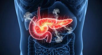 PANXEON Liquid Biopsy Demonstrates Potential for Detecting Early Pancreatic Cancer: © NawManusia - stock.adobe.com