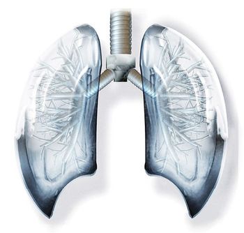 Biomarker analyses indicate the predictive potential of a 15-protein signature related to the efficacy of serplulimab plus chemotherapy in ES-SCLC.