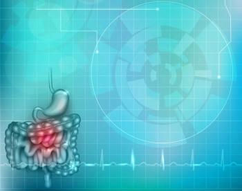 Data from KEYNOTE-585 showed that adding pembrolizumab to chemotherapy did not negatively impact health-related quality of life vs placebo/chemotherapy.