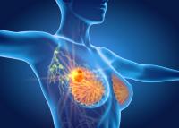 Atezolizumab/NAT May Impact Fertility in TNBC